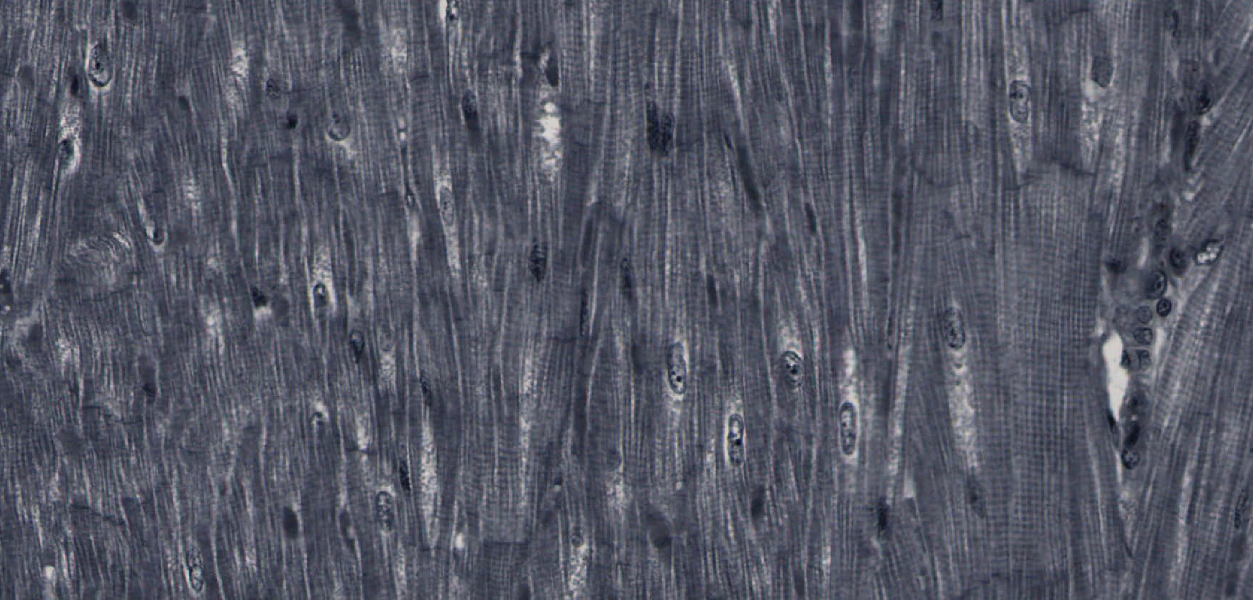 muscle tissue